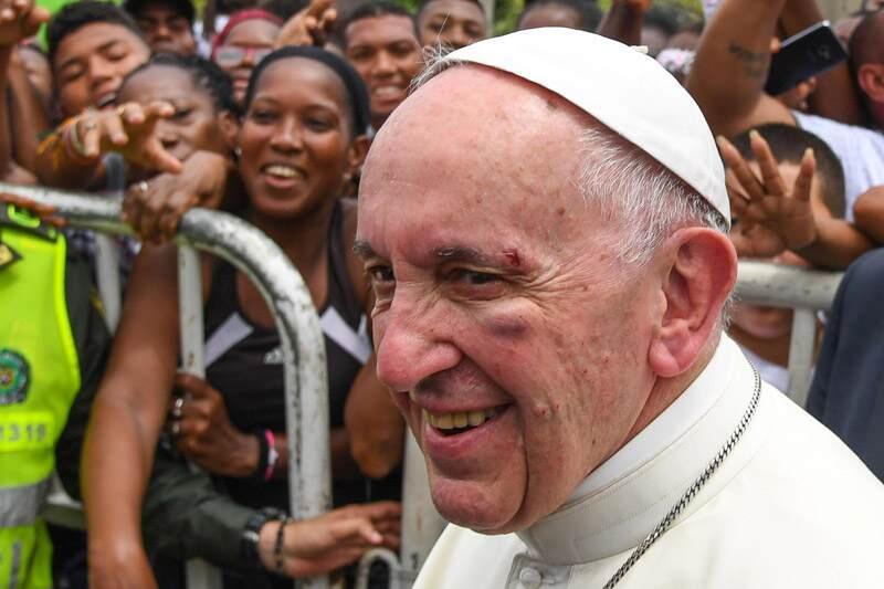 Σοβαρά χτυπημένος ο Πάπας Φραγκίσκος-αίμα στα άμφια